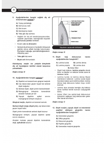 DUS Miadent Soruları ( 8.Baskı ) Peridontoloji